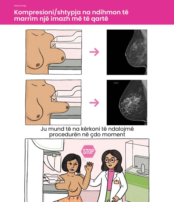 Albanian Compression cover