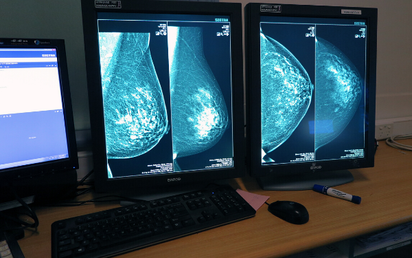 Breast screens on monitors v4