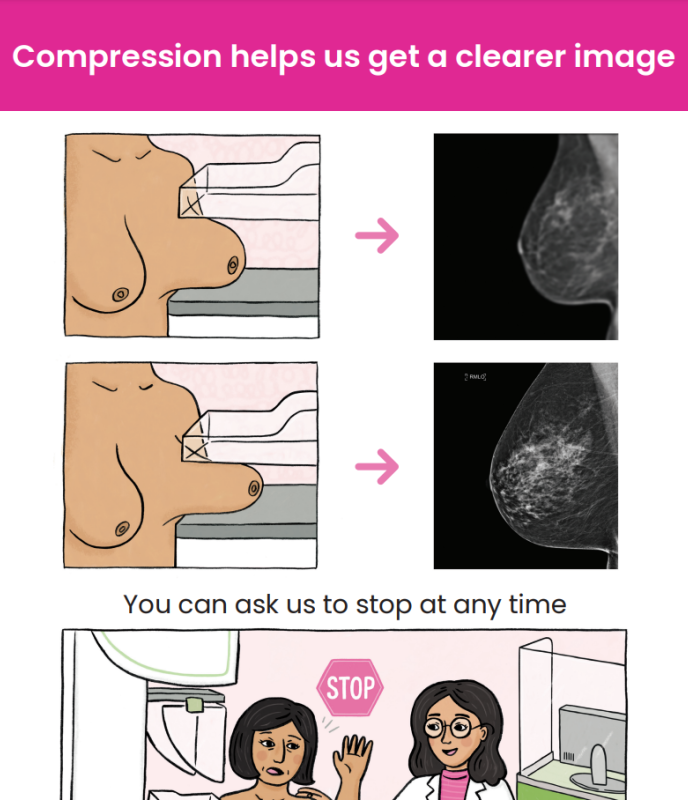 Compression poster thumbnail